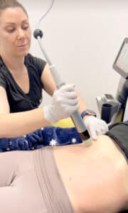 rf microneedling before and after care 638799000b1b2